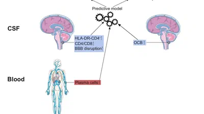 Neurosarcoidosis featured image