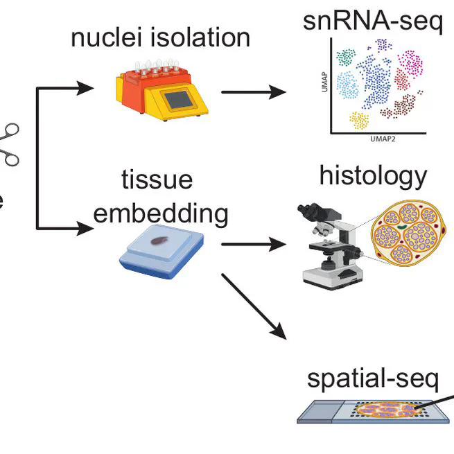 Multi-omic identification of perineurial hyperplasia and lipid-associated nerve macrophages in human polyneuropathies
