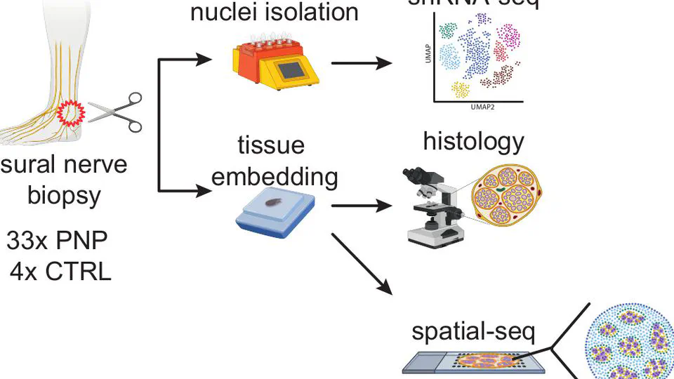 Multi-omic identification of perineurial hyperplasia and lipid-associated nerve macrophages in human polyneuropathies