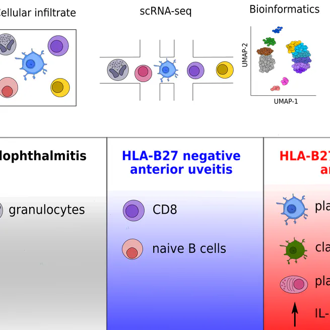 Intraocular dendritic cells characterize HLA-B27-associated acute anterior uveitis